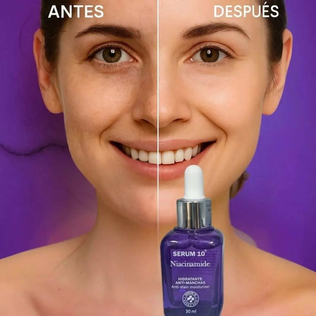 Serum 10 Niacinamida + Ácido Hialurónico